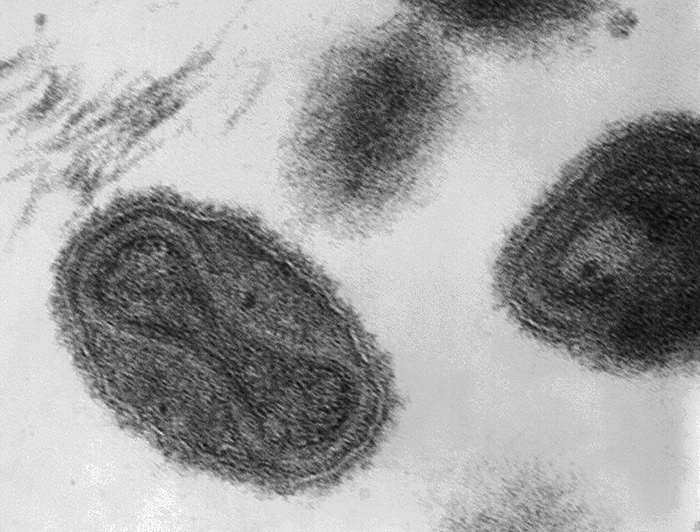 Virus gigantes pertenecientes al grupo Nucleocytoviricota.